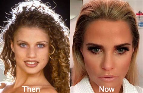 katie price before surgery|Katie Price before surgery: Pictures of the .